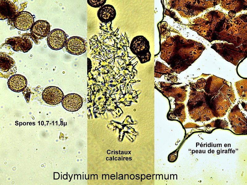 Didymium melanospermum-amf1981-micro.jpg - Didymium melanospermum ; Nom français: Didyme à spores noires 